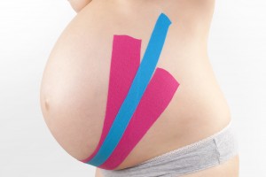 Kinesio Tape On Pregnant.